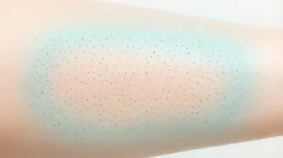 Sinhronizacija rasta dlaka